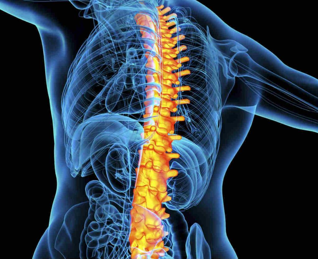 compression-fracture-from-car-accident-fractured-vertebrae-car-accident